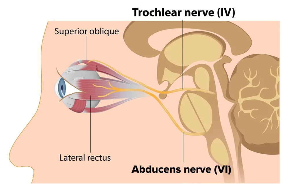 trochlear nerve medbrane