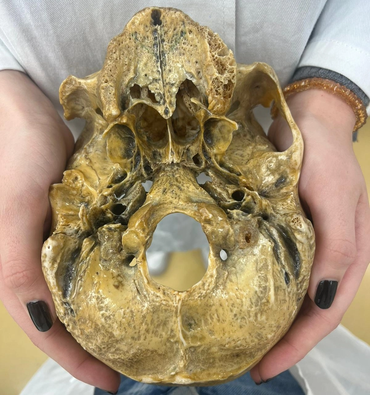 Base of the Skull - Inferior view