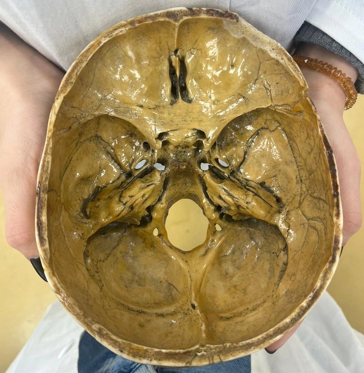 Base of the Skull - Superior view