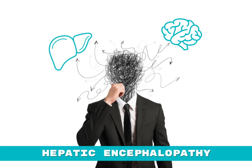 Hepatic Encephalopathy: Signs and Symptoms